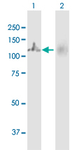 Western blot - Anti-MTHFD1 antibody (AB103698), expandable thumbnail