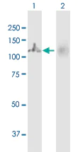 Western blot - Anti-MTHFD1 antibody (AB103698)