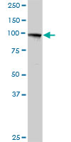 Western blot - Anti-MTHFD1 antibody (AB103698), expandable thumbnail