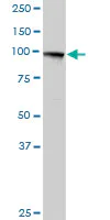 Western blot - Anti-MTHFD1 antibody (AB103698)