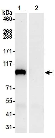 Immunoprecipitation - Anti-MTHFD1 antibody (AB226341)