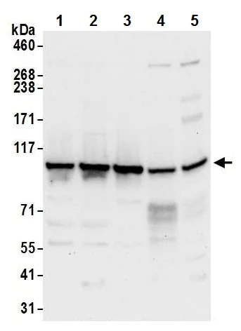 Western blot - Anti-MTHFD1 antibody (AB226341)