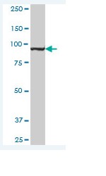 Western blot - Anti-MTHFD1 antibody (AB70203)