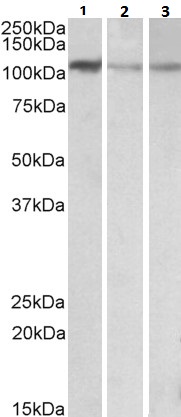 Western blot - Anti-MTHFD1L antibody (AB116615)