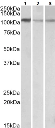 Western blot - Anti-MTHFD1L antibody (AB116615)