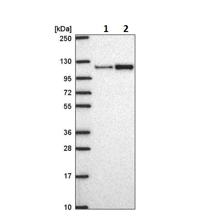 Western blot - Anti-MTHFD1L antibody (AB221925)