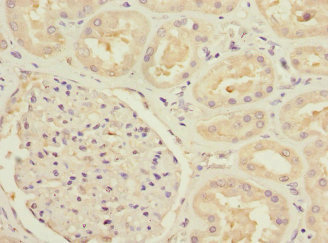 Immunohistochemistry (Formalin/PFA-fixed paraffin-embedded sections) - Anti-MTHFD1L antibody - C-terminal (AB229708)