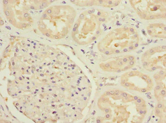 Immunohistochemistry (Formalin/PFA-fixed paraffin-embedded sections) - Anti-MTHFD1L antibody - C-terminal (AB229708)