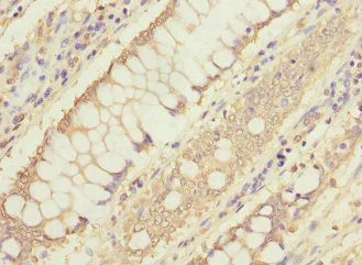 Immunohistochemistry (Formalin/PFA-fixed paraffin-embedded sections) - Anti-MTHFD1L antibody - C-terminal (AB229708)