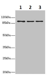 Western blot - Anti-MTHFD1L antibody - C-terminal (AB229708)