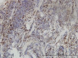 Immunohistochemistry (Formalin/PFA-fixed paraffin-embedded sections) - Anti-MTHFD2 antibody [4G7-2G3] (AB56772)