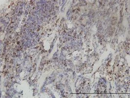 Immunohistochemistry (Formalin/PFA-fixed paraffin-embedded sections) - Anti-MTHFD2 antibody [4G7-2G3] (AB56772)