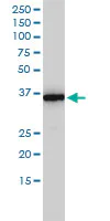 Western blot - Anti-MTHFD2 antibody [4G7-2G3] (AB56772)