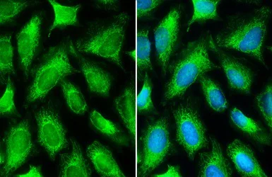 Immunocytochemistry/ Immunofluorescence - Anti-MTHFD2 antibody (AB151447)