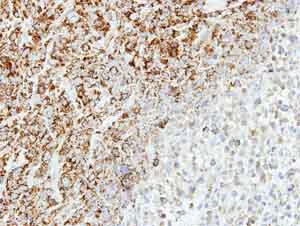 Immunohistochemistry (Formalin/PFA-fixed paraffin-embedded sections) - Anti-MTHFD2 antibody (AB151447)