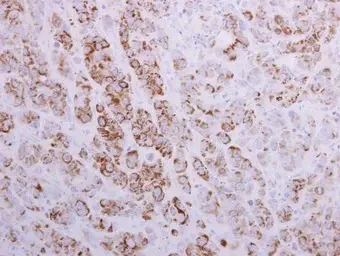 Immunohistochemistry (Formalin/PFA-fixed paraffin-embedded sections) - Anti-MTHFD2 antibody (AB151447)