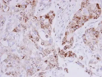 Immunohistochemistry (Formalin/PFA-fixed paraffin-embedded sections) - Anti-MTHFD2 antibody (AB151447)