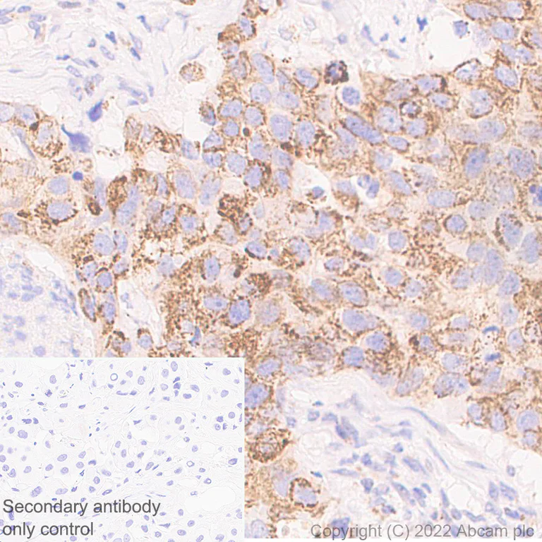 Immunohistochemistry (Formalin/PFA-fixed paraffin-embedded sections) - Anti-MTHFD2 antibody [EPR26938-20] (AB307428)