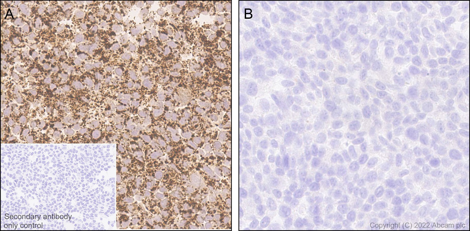 Immunohistochemistry (Formalin/PFA-fixed paraffin-embedded sections) - Anti-MTHFD2 antibody [EPR26938-20] - BSA and Azide free (ab307429), expandable thumbnail