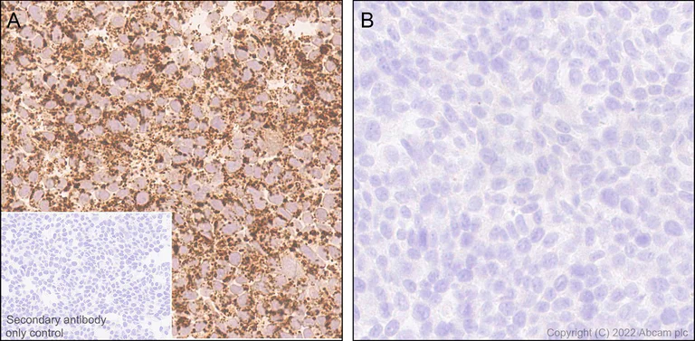 Immunohistochemistry (Formalin/PFA-fixed paraffin-embedded sections) - Anti-MTHFD2 antibody [EPR26938-20] - BSA and Azide free (AB307429)