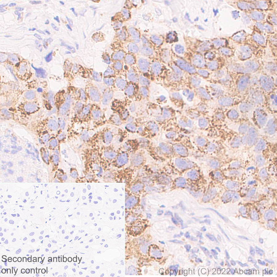 Immunohistochemistry (Formalin/PFA-fixed paraffin-embedded sections) - Anti-MTHFD2 antibody [EPR26938-20] - BSA and Azide free (ab307429), expandable thumbnail