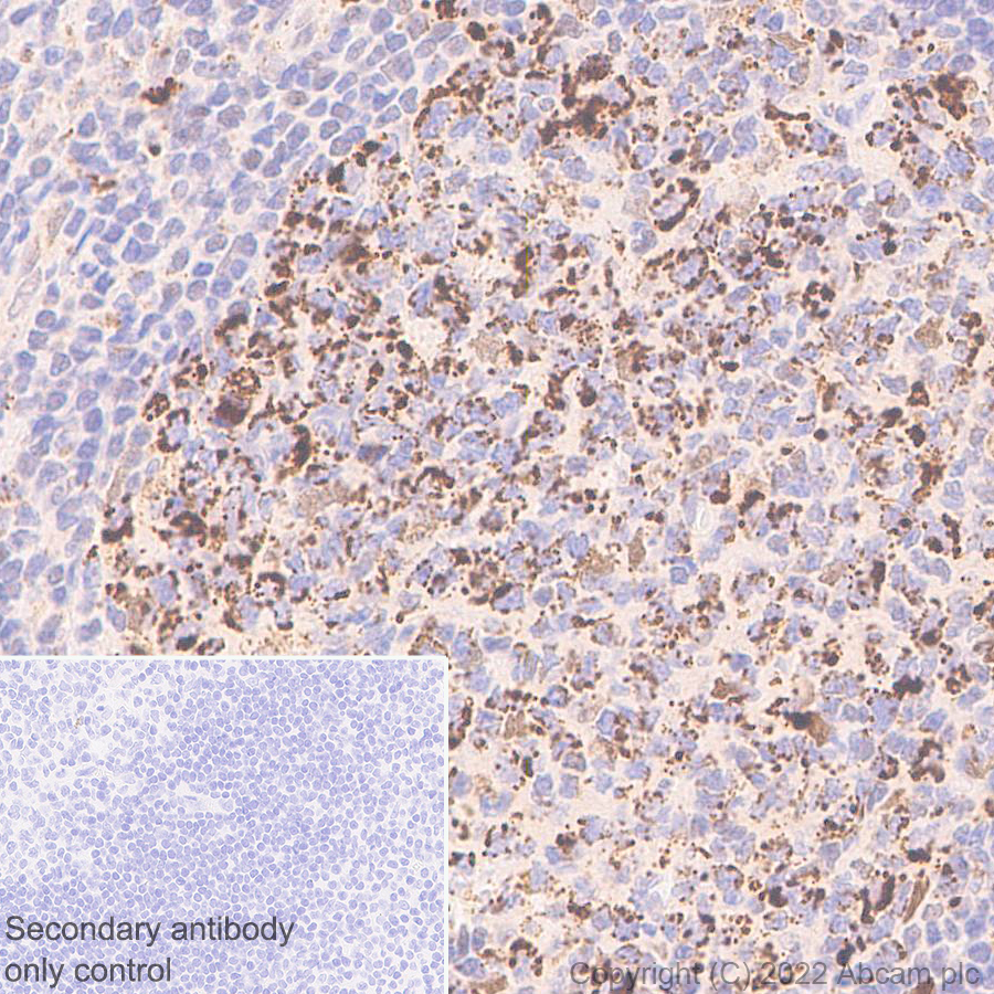 Immunohistochemistry (Formalin/PFA-fixed paraffin-embedded sections) - Anti-MTHFD2 antibody [EPR26938-20] - BSA and Azide free (ab307429), expandable thumbnail