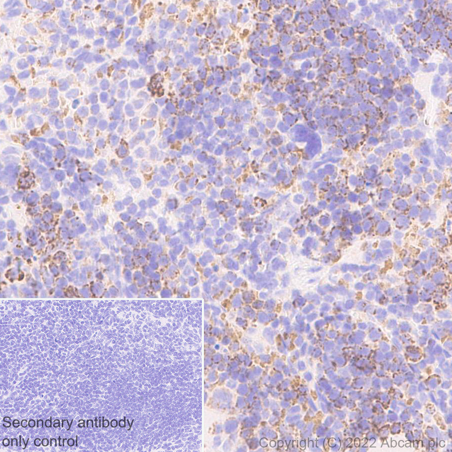 Immunohistochemistry (Formalin/PFA-fixed paraffin-embedded sections) - Anti-MTHFD2 antibody [EPR26938-20] - BSA and Azide free (ab307429), expandable thumbnail