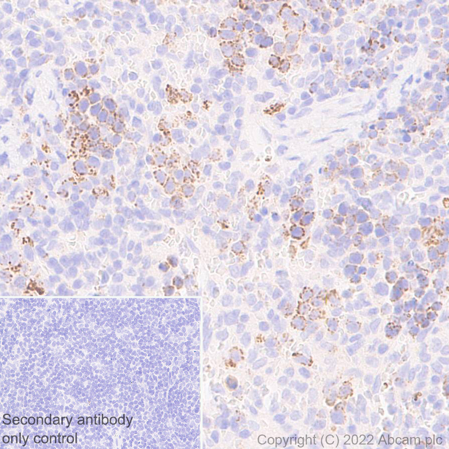 Immunohistochemistry (Formalin/PFA-fixed paraffin-embedded sections) - Anti-MTHFD2 antibody [EPR26938-20] - BSA and Azide free (ab307429), expandable thumbnail