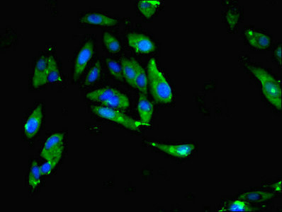 Immunocytochemistry/ Immunofluorescence - Anti-MTHFR antibody (AB236737)