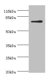 Western blot - Anti-MTHFR antibody (AB236737)