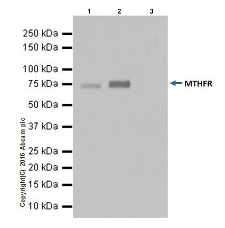 Immunoprecipitation - Anti-MTHFR antibody [EPR19781] - BSA and Azide free (ab251399), expandable thumbnail