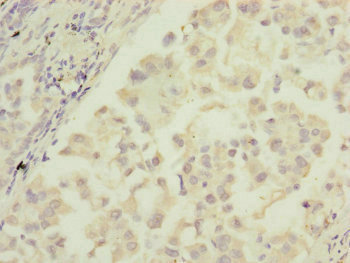Immunohistochemistry (Formalin/PFA-fixed paraffin-embedded sections) - Anti-MTIF3 antibody (AB230321)