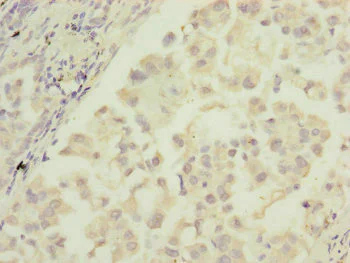 Immunohistochemistry (Formalin/PFA-fixed paraffin-embedded sections) - Anti-MTIF3 antibody (AB230321)