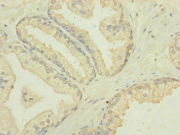 Immunohistochemistry (Formalin/PFA-fixed paraffin-embedded sections) - Anti-MTIF3 antibody (AB230321)