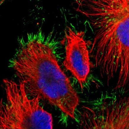 Immunocytochemistry/ Immunofluorescence - Anti-MTM1 antibody (AB223719)