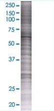 MTM1 overexpression 293T lysate (whole cell)