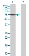Western blot - MTM1 overexpression 293T lysate (whole cell) (AB94167)