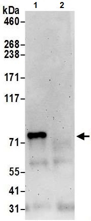 Immunoprecipitation - Anti-MTMR1 antibody (AB240569)