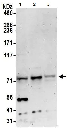 Western blot - Anti-MTMR1 antibody (AB240569)