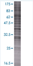 SDS-PAGE - MTMR1 overexpression 293T lysate (whole cell) (AB94170), expandable thumbnail