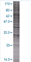 SDS-PAGE - MTMR1 overexpression 293T lysate (whole cell) (AB94170)