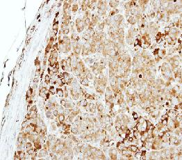Immunohistochemistry (Formalin/PFA-fixed paraffin-embedded sections) - Anti-MTMR14 antibody (AB102575)