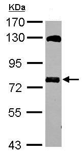 Western blot - Anti-MTMR14 antibody (AB102575)