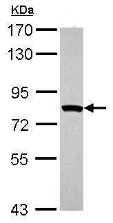 Western blot - Anti-MTMR2 antibody (AB155678), expandable thumbnail