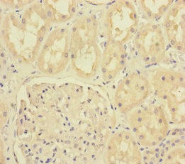 Immunohistochemistry (Formalin/PFA-fixed paraffin-embedded sections) - Anti-MTO1 antibody (AB235381), expandable thumbnail