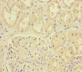 Immunohistochemistry (Formalin/PFA-fixed paraffin-embedded sections) - Anti-MTO1 antibody (AB235381)