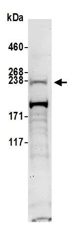 Western blot - Anti-mTOR antibody (AB245370)