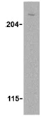 Western blot - Anti-mTOR antibody (AB25880)