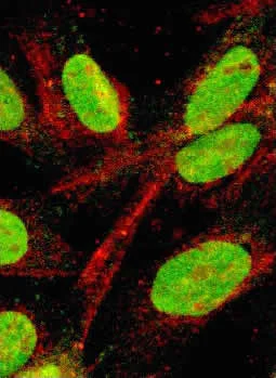 Immunocytochemistry/ Immunofluorescence - Anti-mTOR antibody (AB2732)