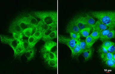 Immunocytochemistry/ Immunofluorescence - Anti-mTOR antibody - C-terminal (AB137341)